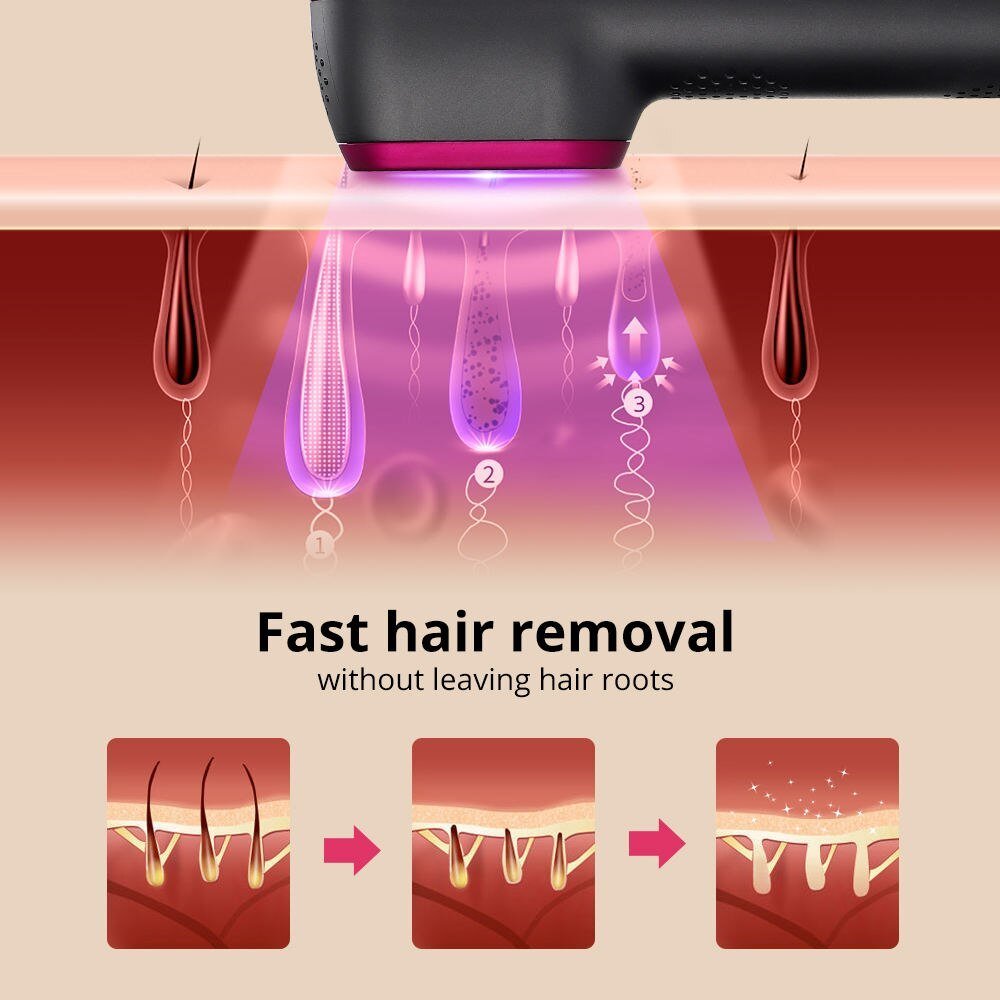 10 0000 Flashes IPL Hair Removal Device For Home 5 - speed Pulse Light Painless Laser Hair Removal Device - Weriion