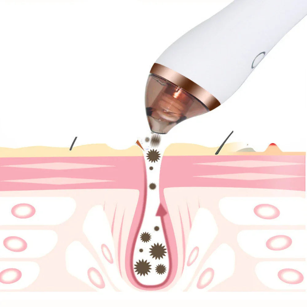 Blackhead Remover Machine Facial Pore Deep Cleansing Beauty Skin Care
