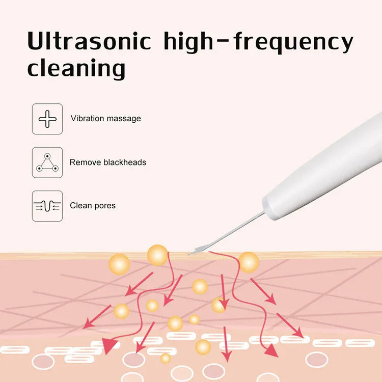Exfoliating Ultrasonic Skin Scrubber Beauty Device With Ergonomic Curve Design