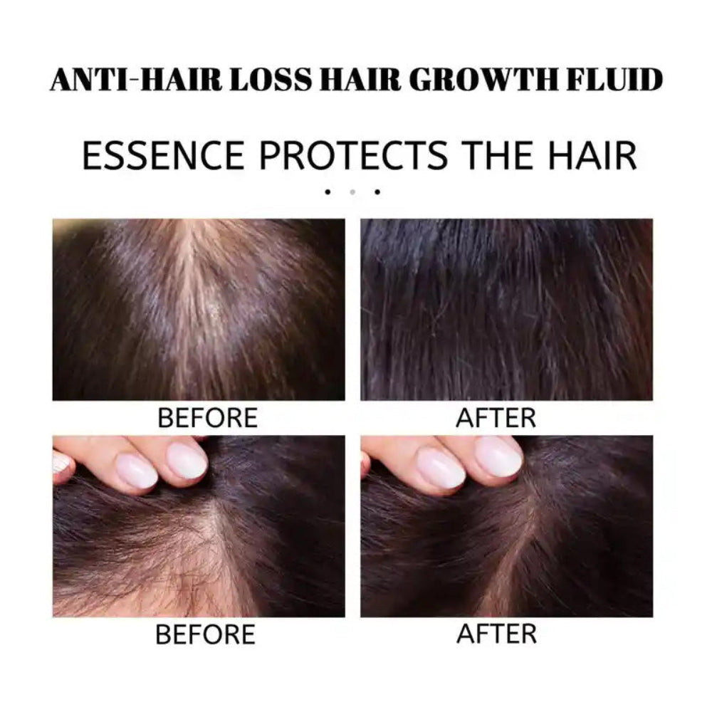 Anti-Hair Loss Hair Regrowth Oil