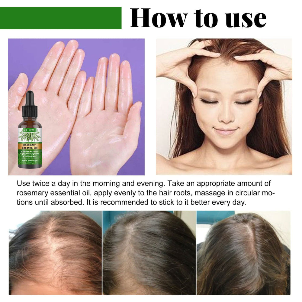 Rosemary Hair Care Essential Oil Anti Hair Loss Nourish Scalp Hair Roots For Growth