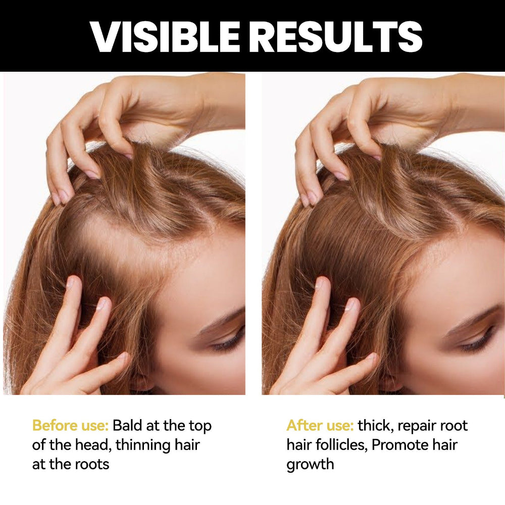 Men & Women Essential Dense Hair Growth Oil