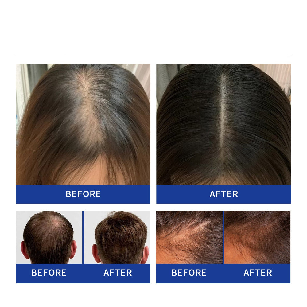 Gentle Nourishing Scalp Strong Hair Soft And Shiny Hair Care Spray