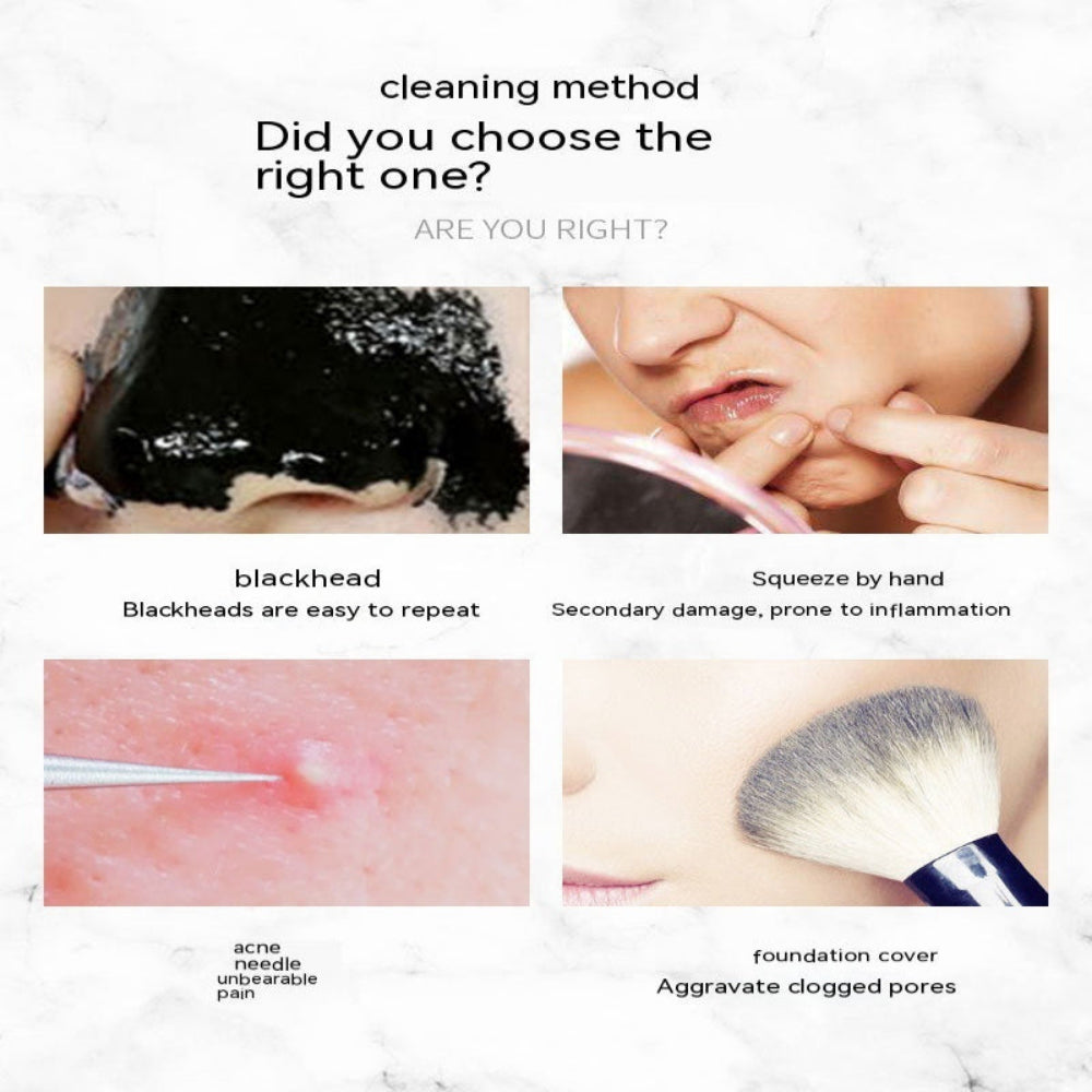 Ultrasonic Skin Care Scraper Blackhead Remover