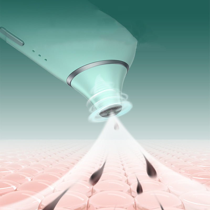 Electric Visual Blackhead Remover Facial Acne Pore Cleaner - Weriion