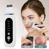 Ultrasonic Facial Skin Scrubber For Skin Care Acne & Blackhead Removal