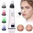 BlackHead Remover With Several Removable Suction Heads - Weriion