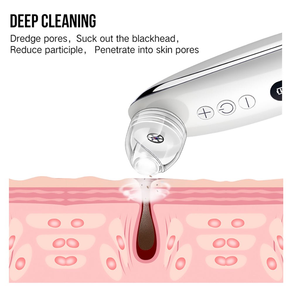 Comfortable & Effective Facial Blackhead Remover - Weriion