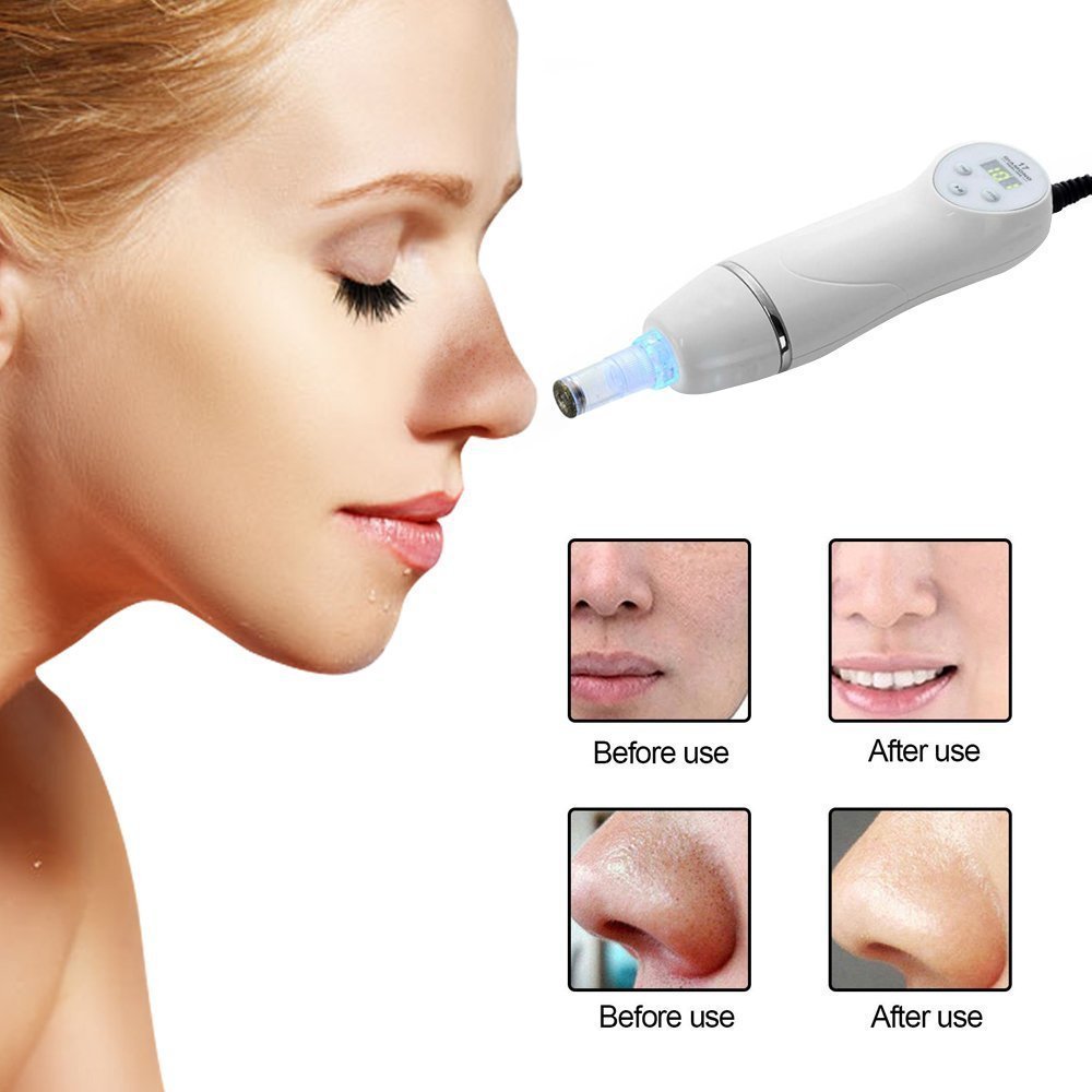 Electric Pore Cleaner Blackhead Remover - Weriion