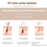 IPL Hair removal Device For Permanent Hair Loss With 990 000 Flashes - Weriion