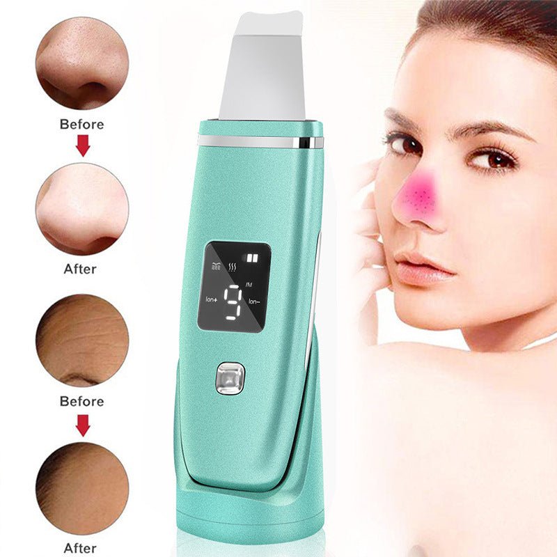 Ultrasonic Vibration Blackhead & Acne Removal Deep Cleansing Face Scrubber With Peeling Shovel - Weriion