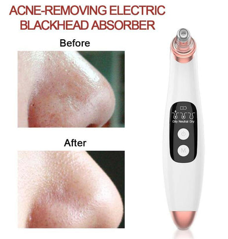 USB Electric Vacuum Suction Blackhead Remover With LED Display For Deep Pore Cleansing - Weriion