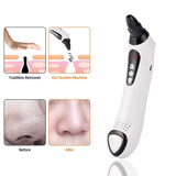 Vacuum Suction Skin Care Pore Deep Cleansing Acne Pimple Blachead Remover - Weriion