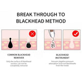 Deep Pore Cleansing Blackhead Remover - Weriion