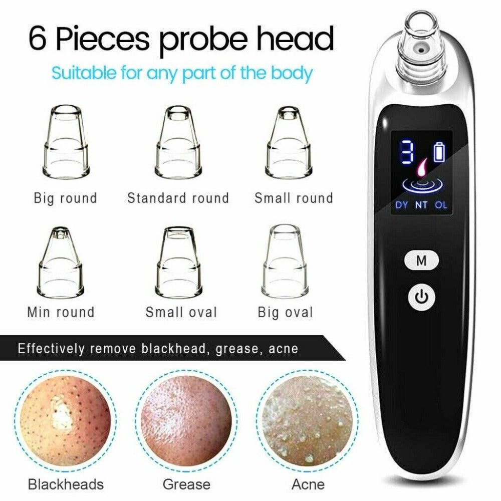 Electric Blackhead Remover With Six Different Suction Heads - Weriion